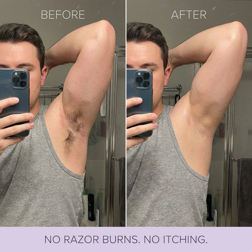 Hair Removal Mousse